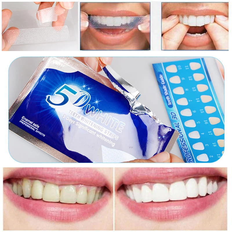 Fita PAP+ - Adesivo para Clareamento Dental