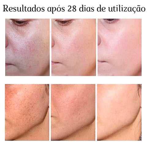 Creme Clareador de Virilha e Axilas®