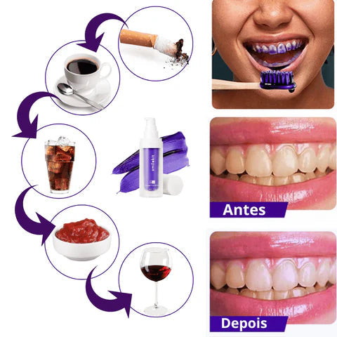 Pasta Clareadora Instantânea - Smilekit V34 - 2 Unidades