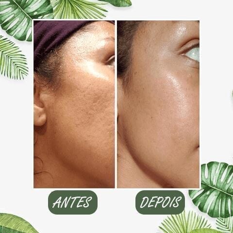 Mascara Removedora de Cravos - Green Mask®