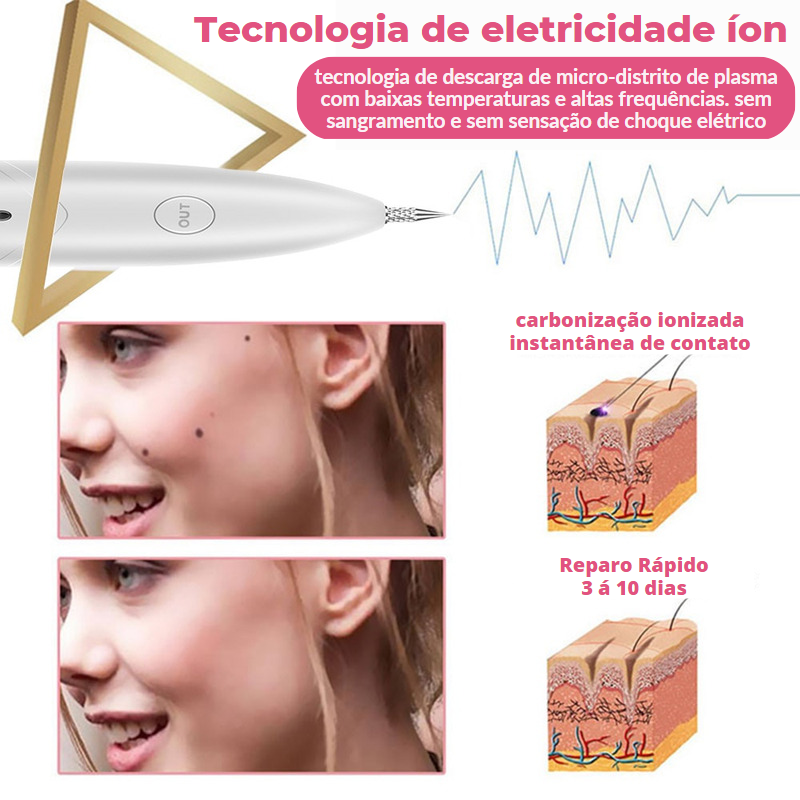 Electric Pen™ - Caneta Elétrica Removedora De Manchas + Brindes Exclusivos