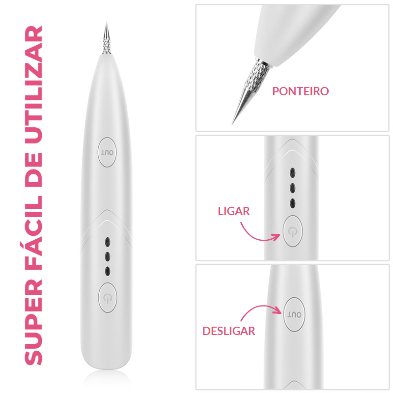 Electric Pen™ - Caneta Elétrica Removedora De Manchas + Brindes Exclusivos