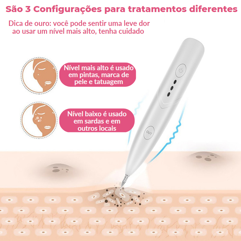 Electric Pen™ - Caneta Elétrica Removedora De Manchas + Brindes Exclusivos