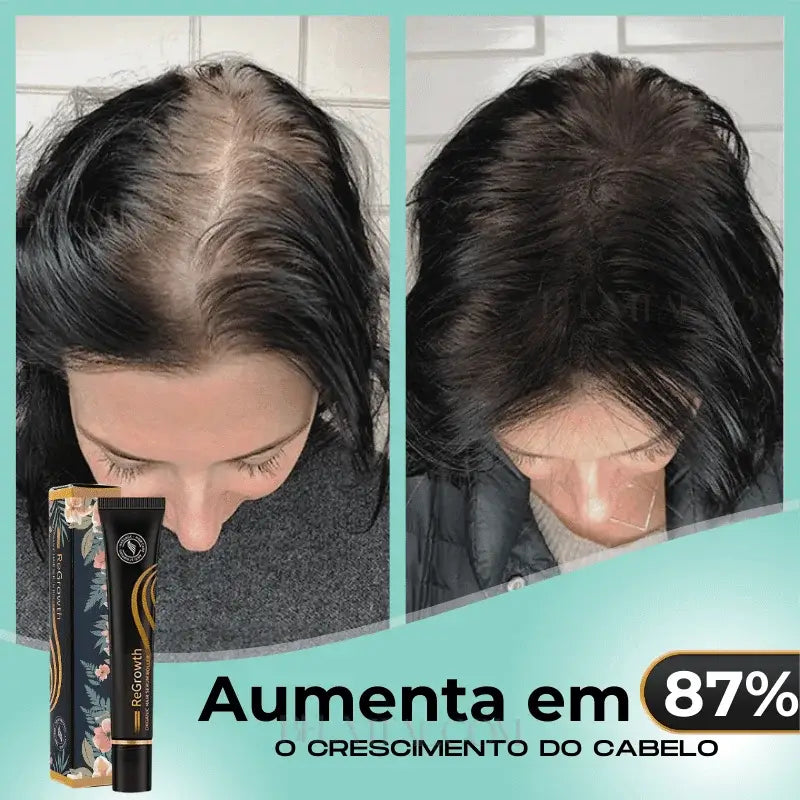 Sérum Repair Hair: Tratamento Revolucionário para Queda de Cabelo