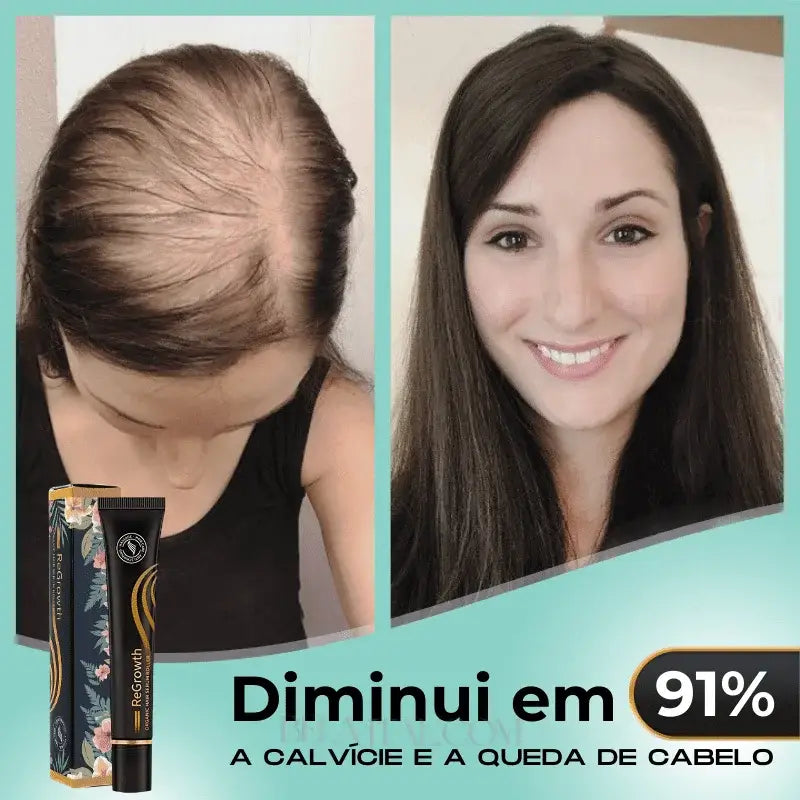 Sérum Repair Hair: Tratamento Revolucionário para Queda de Cabelo