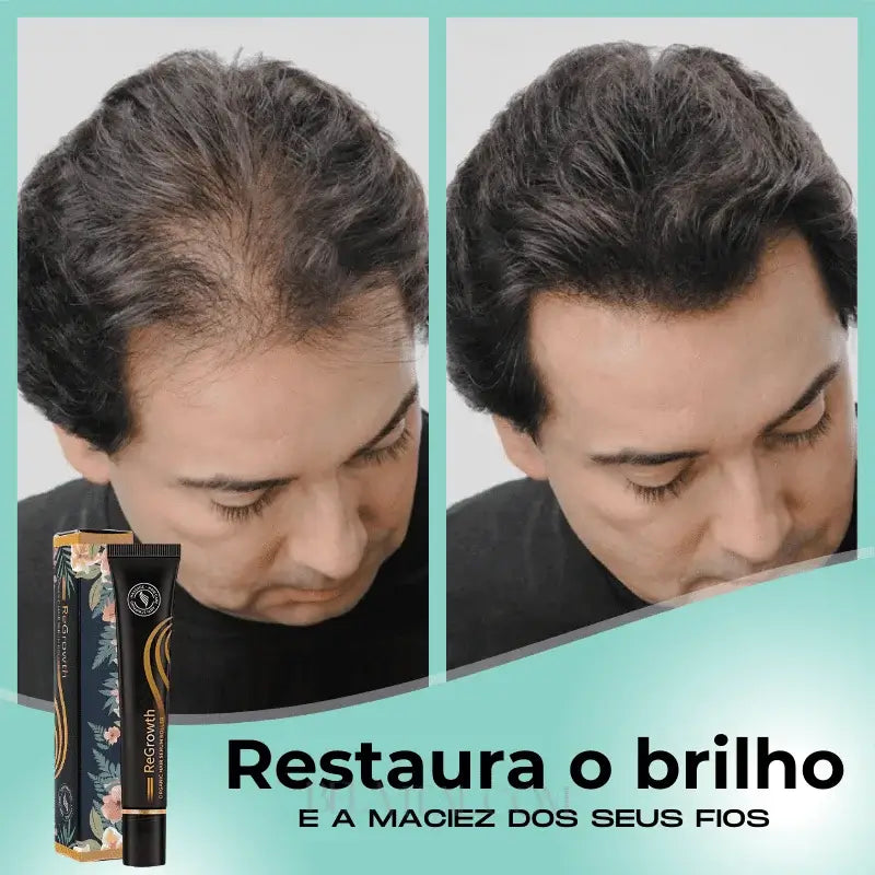 Sérum Repair Hair: Tratamento Revolucionário para Queda de Cabelo