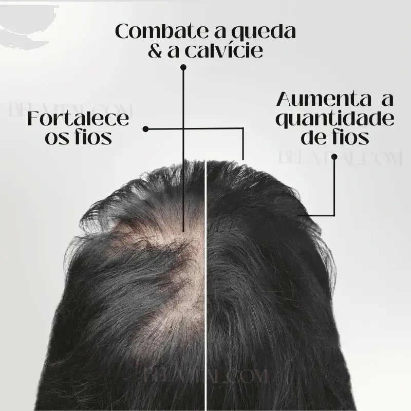 Sérum Repair Hair: Tratamento Revolucionário para Queda de Cabelo